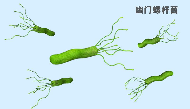 警惕这些症状提示可能感染幽门螺杆菌