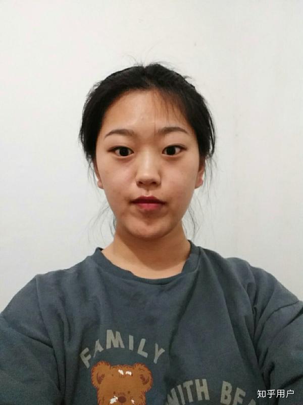 这是,,死鱼眼?虽然是b612?