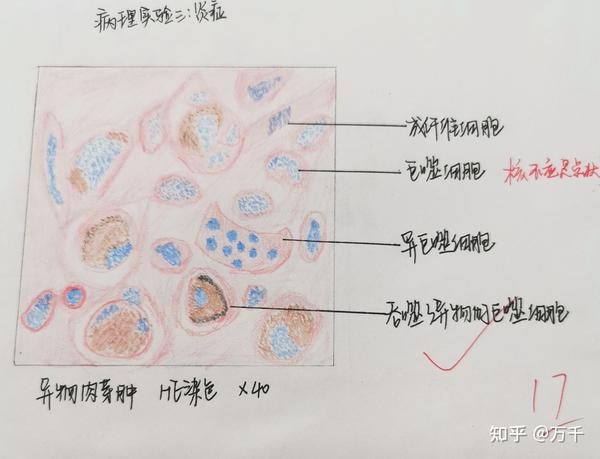 病理学红蓝铅笔绘图