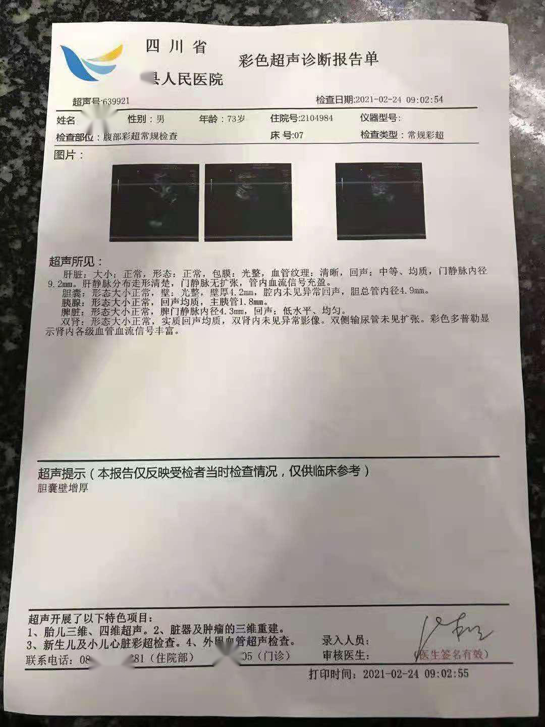 吴孟达确诊肝癌到去世不到3个月这位肝癌患者肿块却缩小了近一半治疗