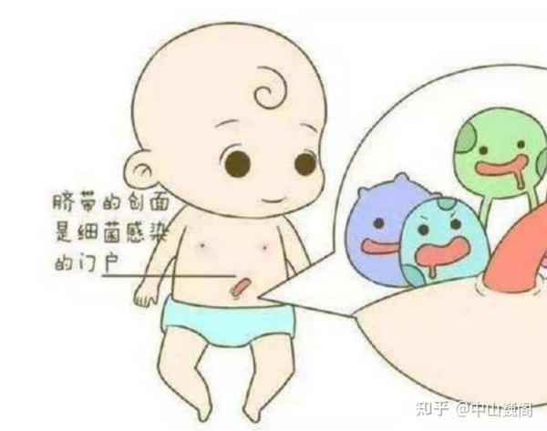 宝宝护理:新生儿脐带应怎么护理?