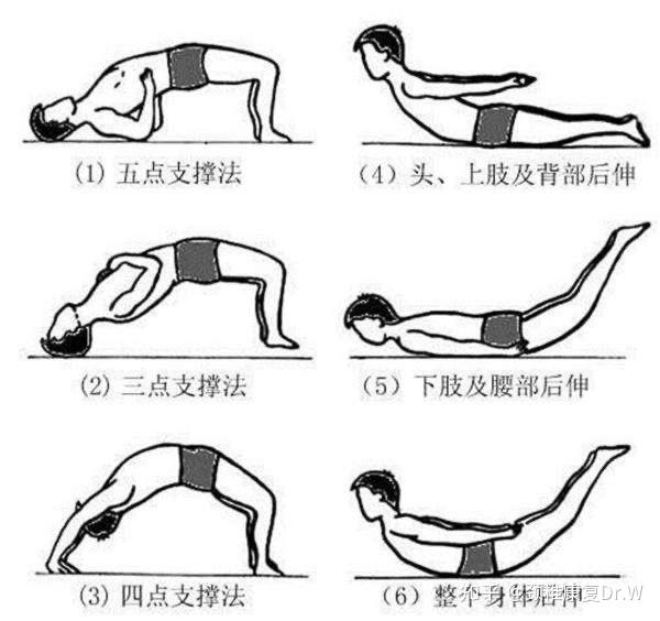 锻炼可以矫正改善轻度脊柱侧弯嘛?
