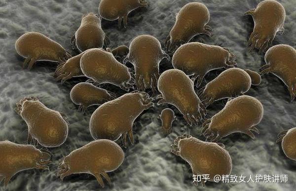 越敷面膜越长痘很可能是在喂养螨虫再不清除螨虫吃空皮肤