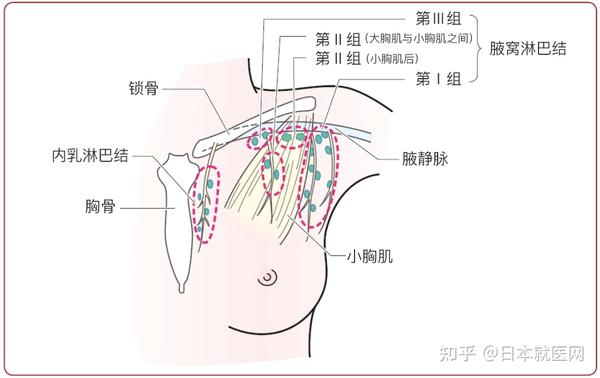图1.乳腺淋巴结