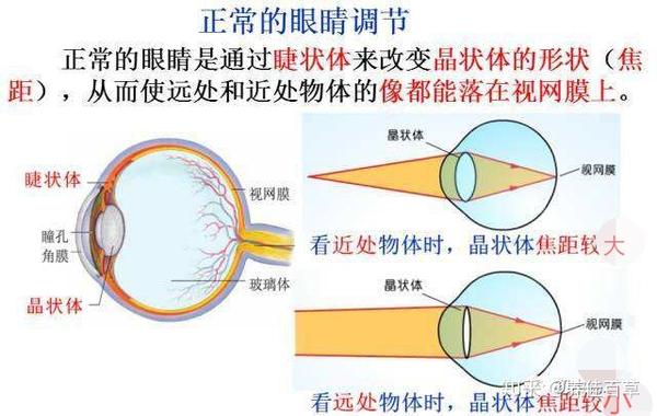睫状肌需要收缩来使晶状体变凸,而                    与,而使眼部