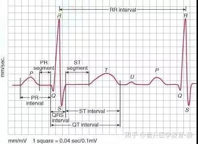 所有的12个导联(肢体导联Ⅰ,Ⅱ,Ⅲ,avr,avl,avf;胸导联v1,v2,v3,v