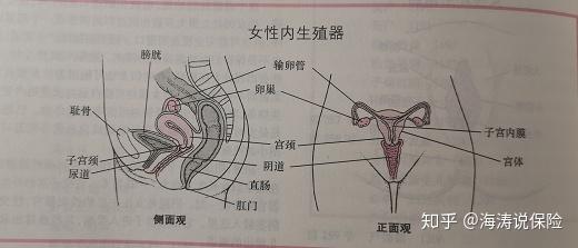 子宫肌瘤投保指南