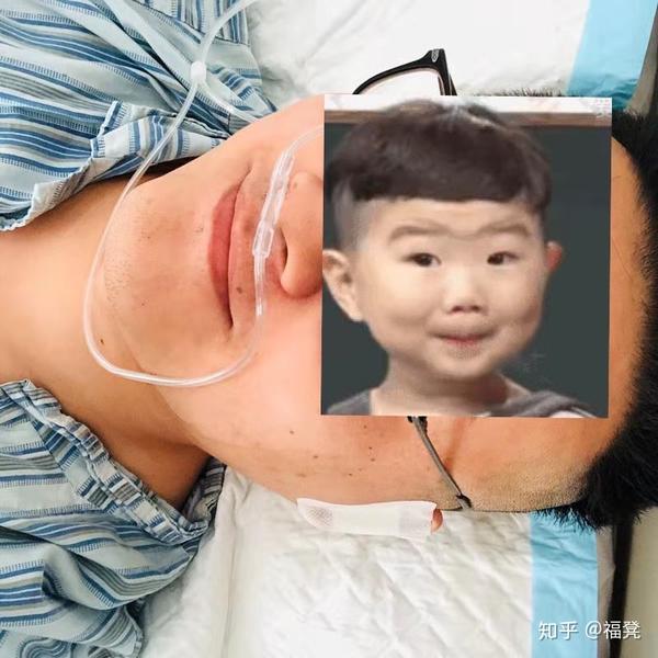 这是手术后返回病房在病床上,自拍的照片,哈哈哈