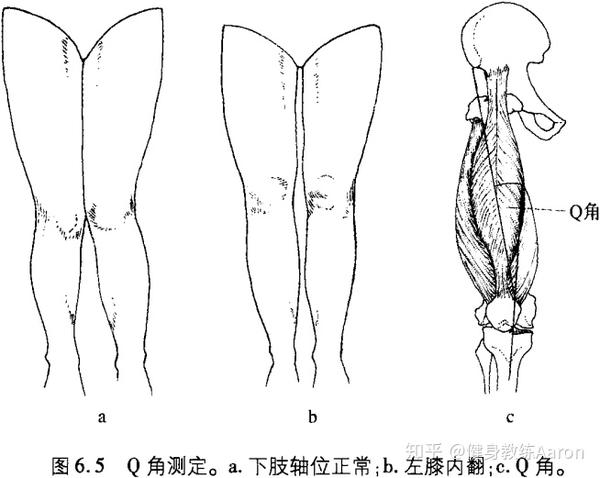 何为q角?膝痛和它的关系是怎么样的