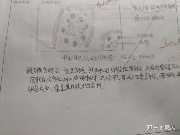 病理学红蓝绘图