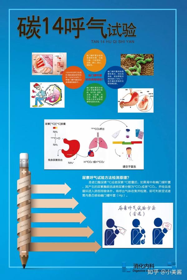 消灭幽门螺杆菌不成功会有什么影响