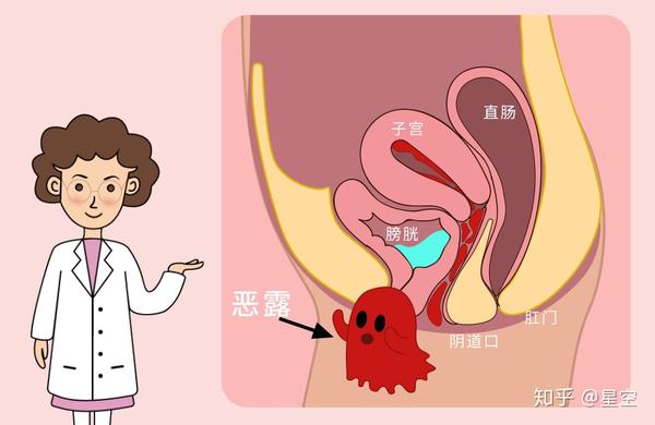 你的产后恶露正常吗?