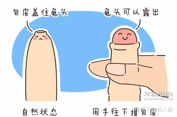 关于男生该不该包皮的问题,真实经历告诉你答案.