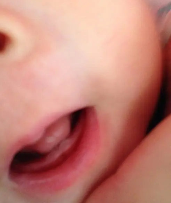 宝宝10个月没出牙要不要补钙