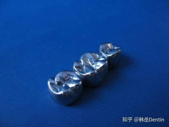 根管治疗牙冠