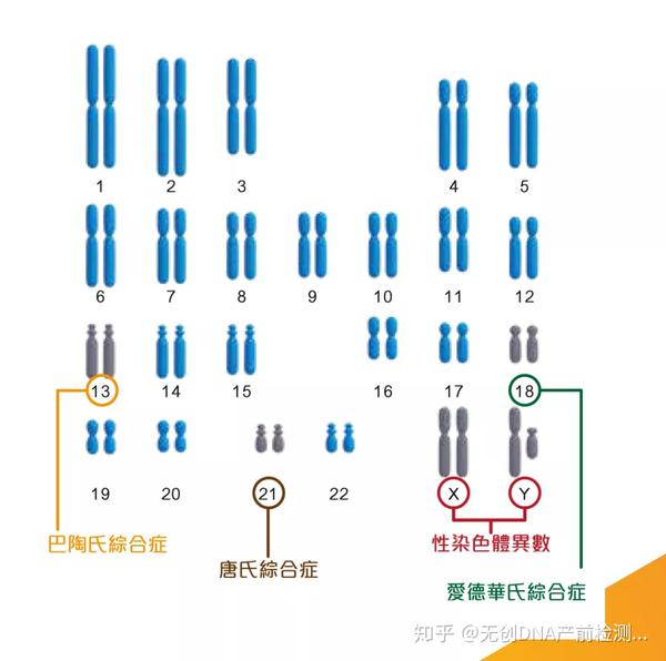 xo x染色体单体症 xxx超雌综合征 xxy柯林菲特氏症 xyy 超雄综合症 微