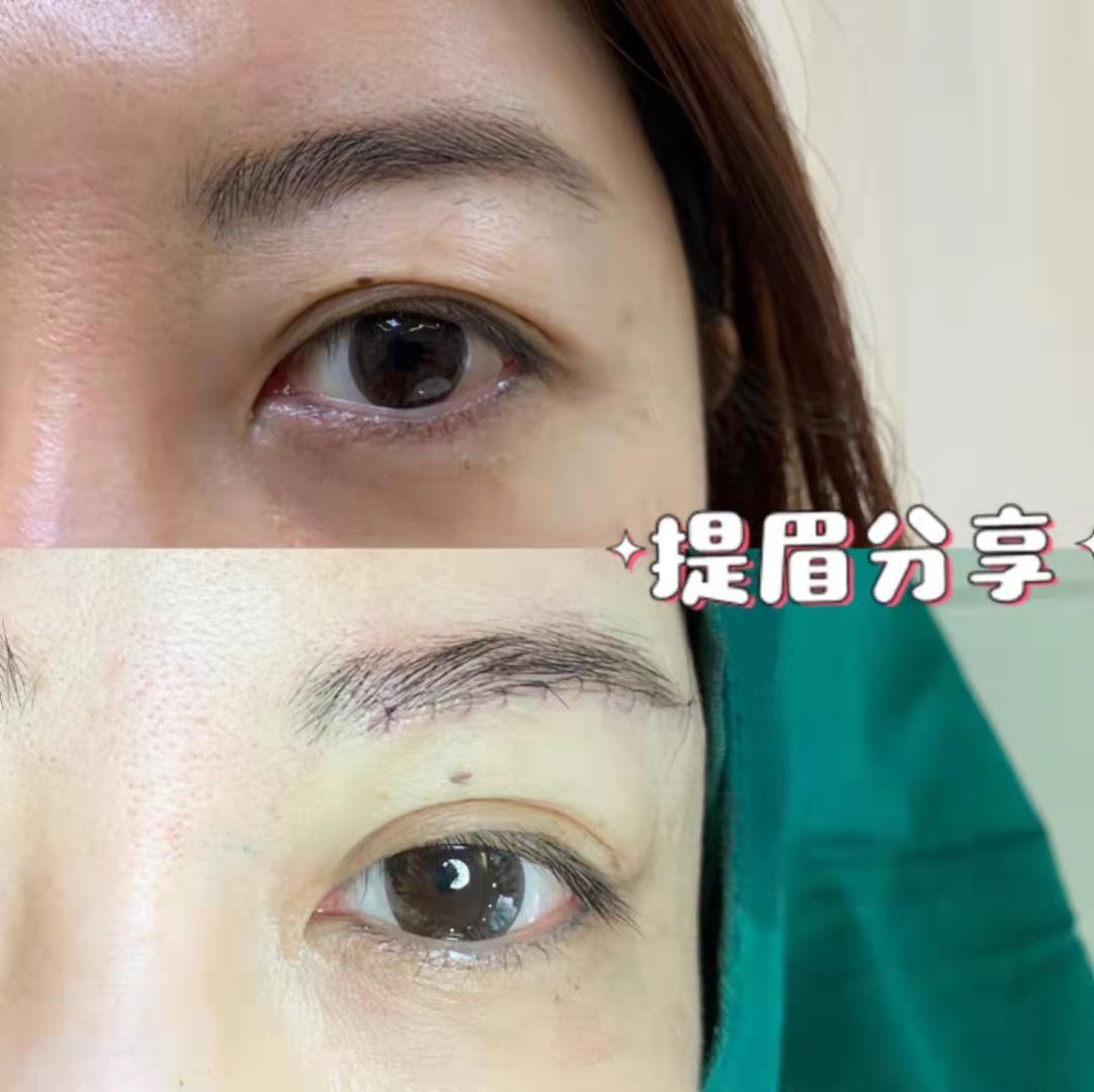 做完提眉之后变得更凶了