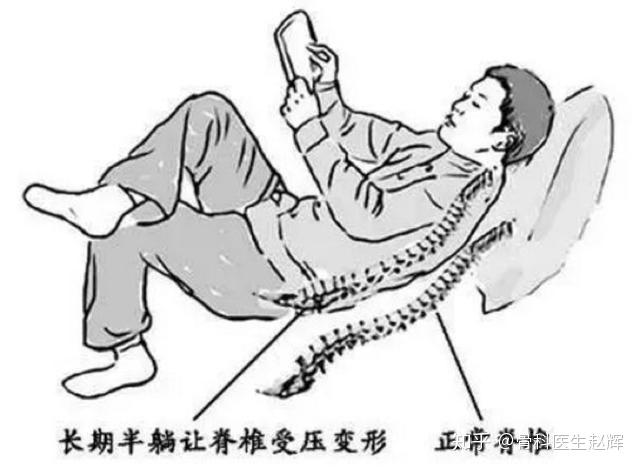 二郎腿,葛优瘫——你最爱的姿势伤你却最深