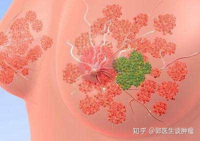 什么是乳腺癌的保乳手术?切乳和保乳哪个复发率高?