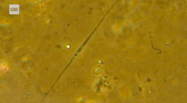 显微镜下的"海鼻涕"   图源:cnn