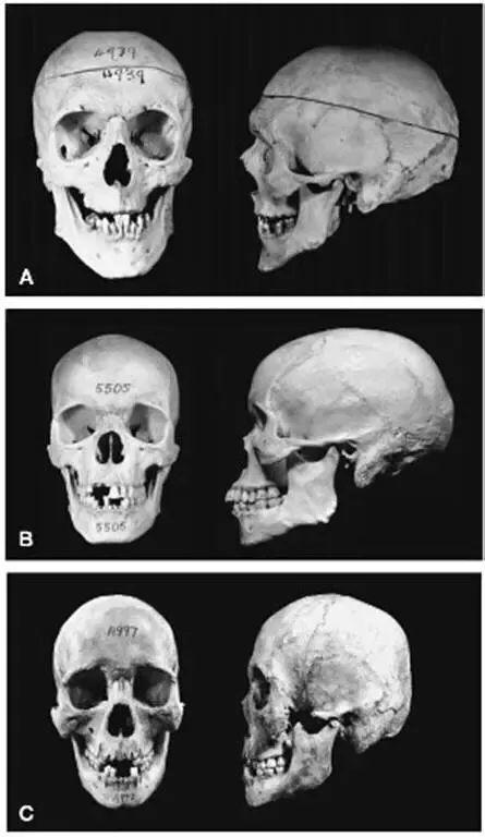 (从上往下依次是白人,黑人,东亚人的头骨对比)