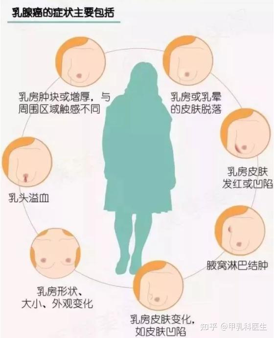 有乳腺癌家族史下一代一定会得乳腺癌吗