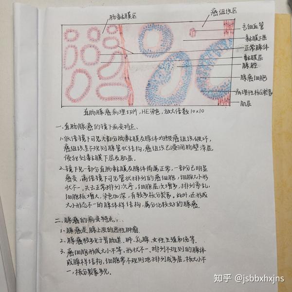 急性蜂窝织性阑尾炎 3.直肠腺癌 4.淋巴结转移癌 5.门脉性肝硬化 6.