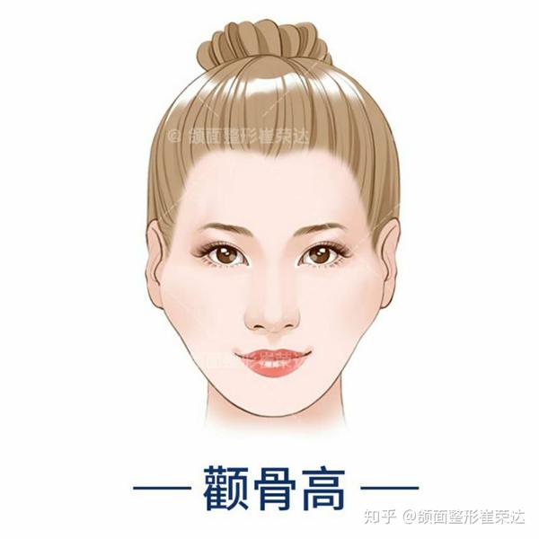是颧骨高?还是太阳穴凹陷?到底该怎么判断?