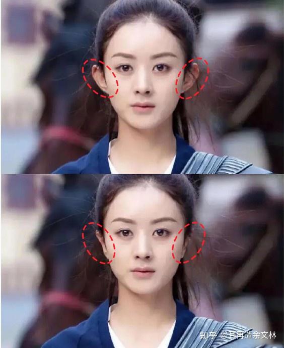 其实看上面这张图也可以发现,耳朵大且舒展会显得脸小,耳朵小且贴脑