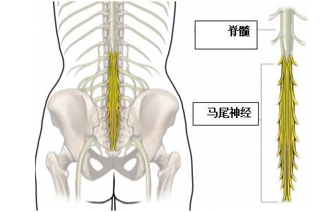 肛门会阴有异样感马尾神经受压