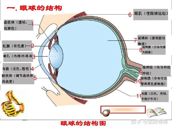 圆锥角膜