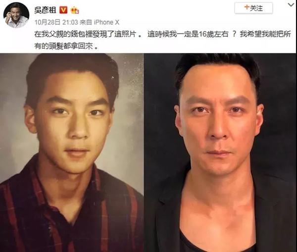 秃头危机陈赫难道发际线只欺负男人和老人杨紫的发际线扎心了