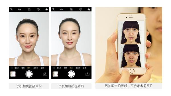 尴尬…… 手机自带图库查看照片只能一张一张看,医拍却采用两张对比