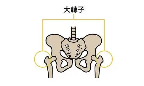 假胯其实是股骨大转子突出, 股骨与身体中心线偏离角度较大.