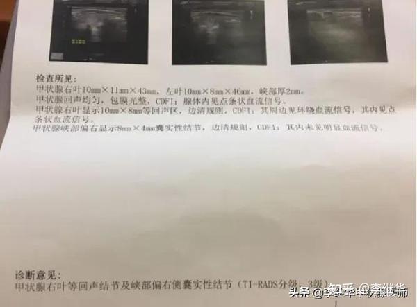 2,3级甲状腺结节要不要切?定期复查还是要干预治疗?