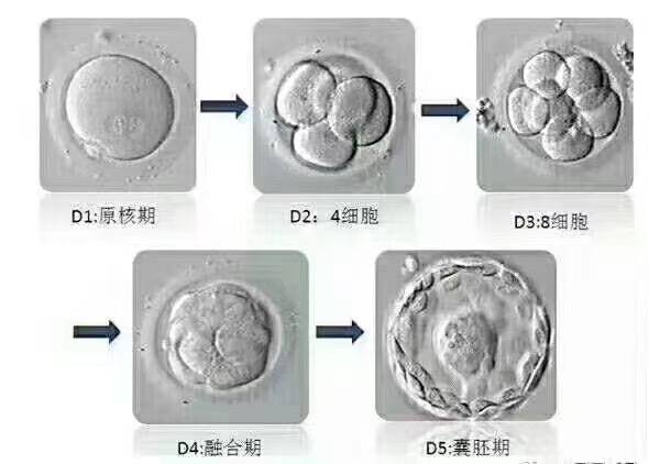 鲜胚,囊胚,冻胚,哪个移植成功率更高?