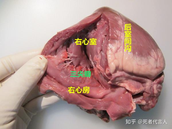 刚才图上有个前室间沟,这个后室间沟就是对应的心脏后面的,就把它们