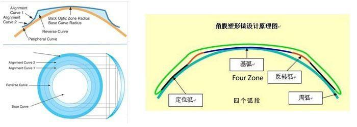 ok镜角膜塑形镜真的对儿童近视有治疗作用吗有没有副作用