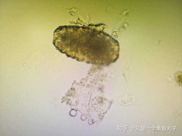 布氏姜片吸虫(姜片虫) 美洲板口线虫(美洲钩虫)  原虫纲 溶组织内