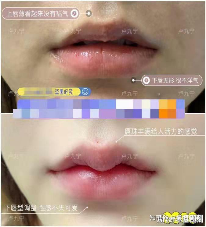 有没有人做过m唇给一点点建议