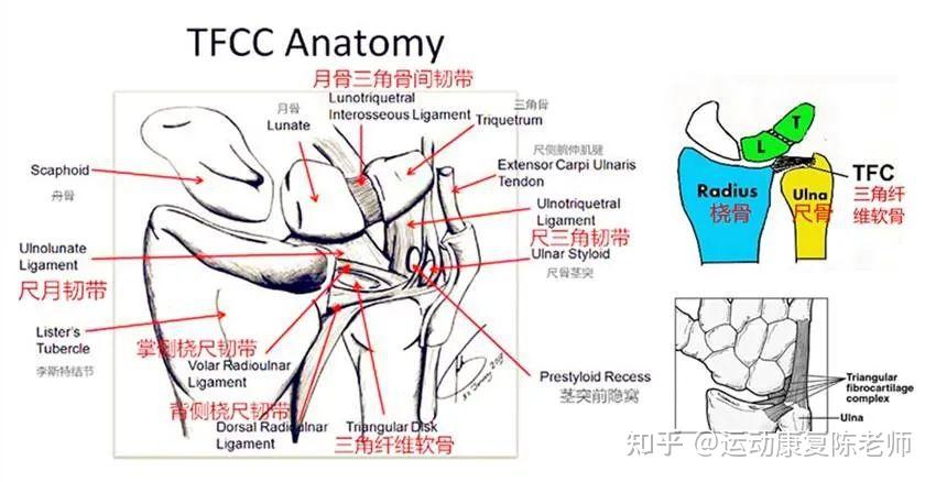 三角纤维软骨tfcc损伤该如何治疗和康复呢