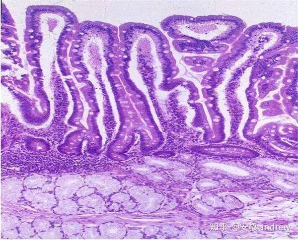 小肠上皮     来源:网络