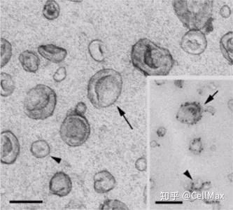 electron microscopy, tem)等电子显微镜可用于外泌体鉴定