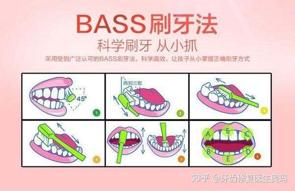 1,正确的刷牙方式bass(避免大力横刷)