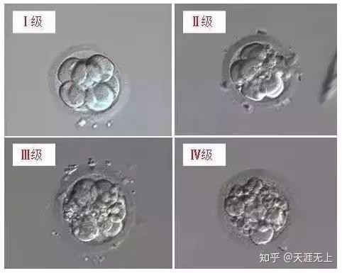 试管婴儿胚胎竟分等级?什么样胚胎更容易怀孕?