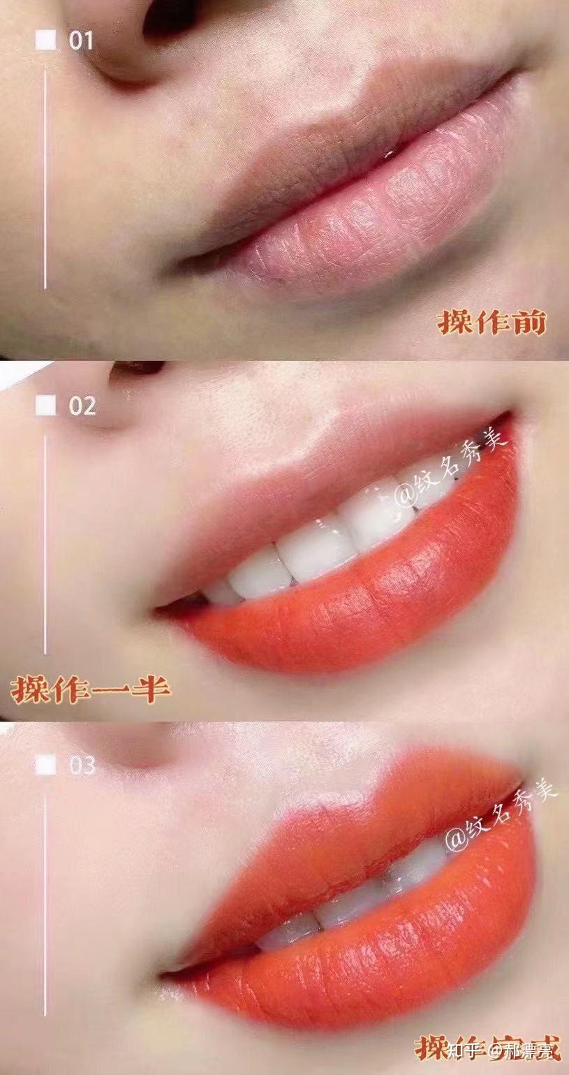 北京纹唇 - 知乎
