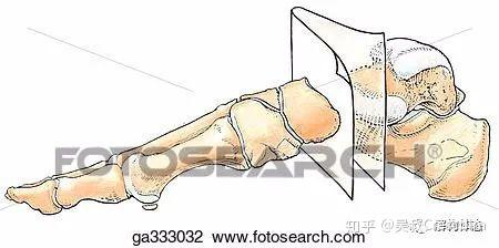 横跗关节理解足踝损伤与生物力学的关键