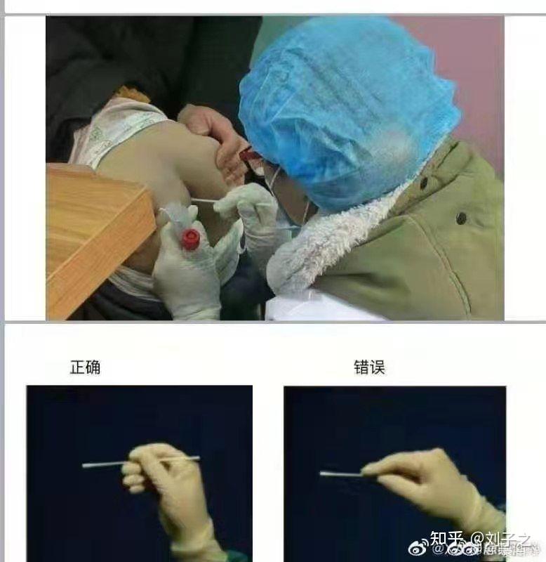 接受肛拭子采样是怎样的体验