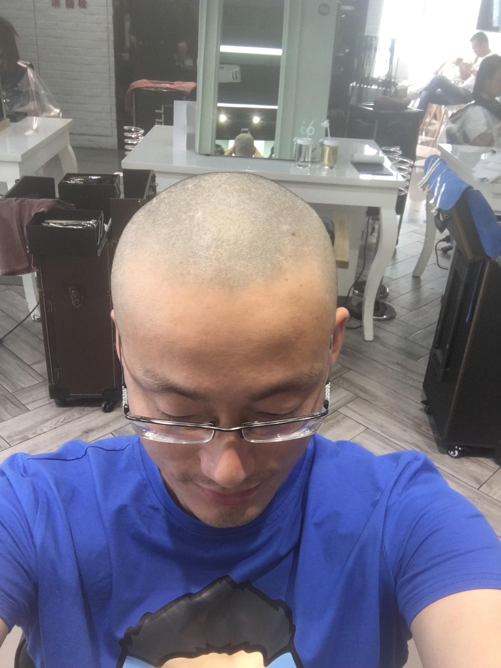 光头