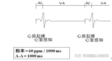 心脏起搏心电图概念与基础